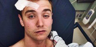 Calum McSwiggan attacked and hospitalized