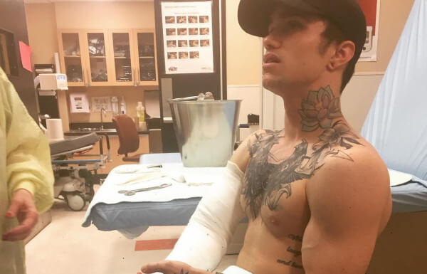 Gay Porn Star Jake Bass Breaks His Arm In A Gus Kenworthy Type